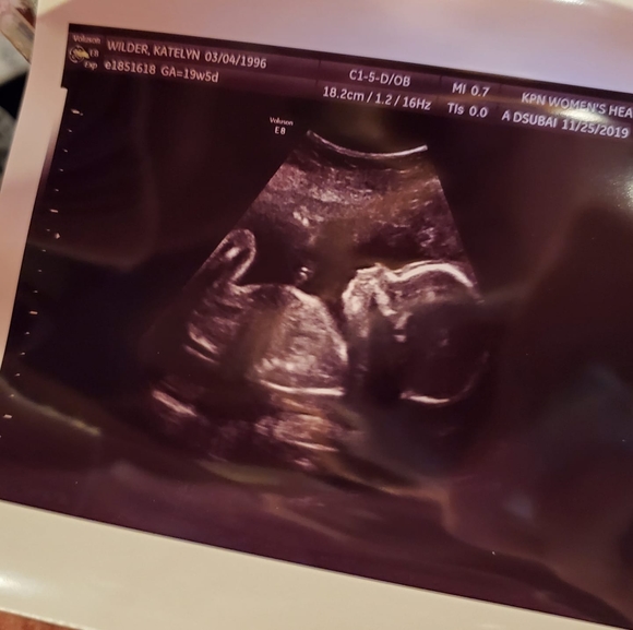 Meet your Posher, Katelyn nicole - Picture 1 of 1